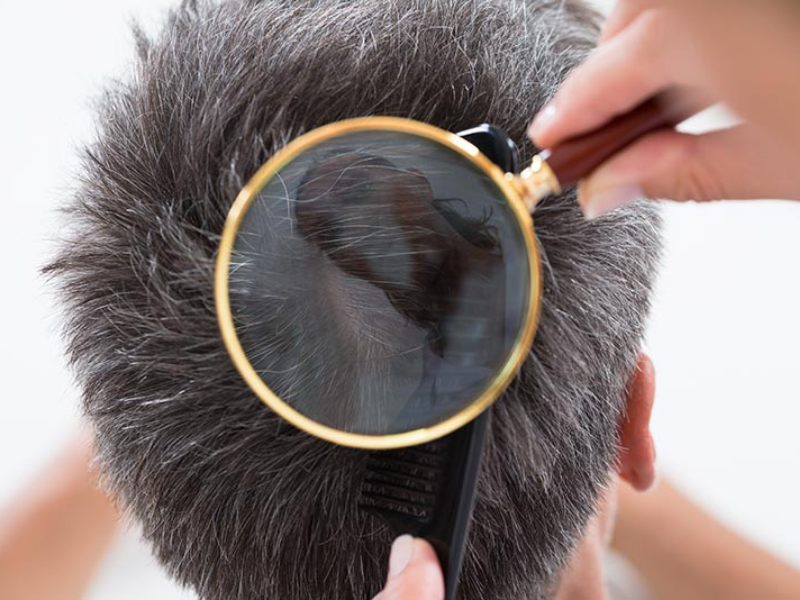 Cách chăm sóc và phục hồi tóc nam bị khô xơ hư tổn