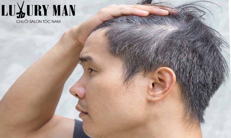 nguyên nhân tóc bạc sớm ở nam giới