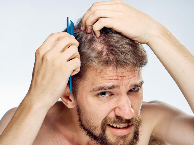 Tóc xơ cứng phải làm sao Thử ngay 1001 cách giúp tóc mềm mượt